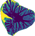 cerebellum image